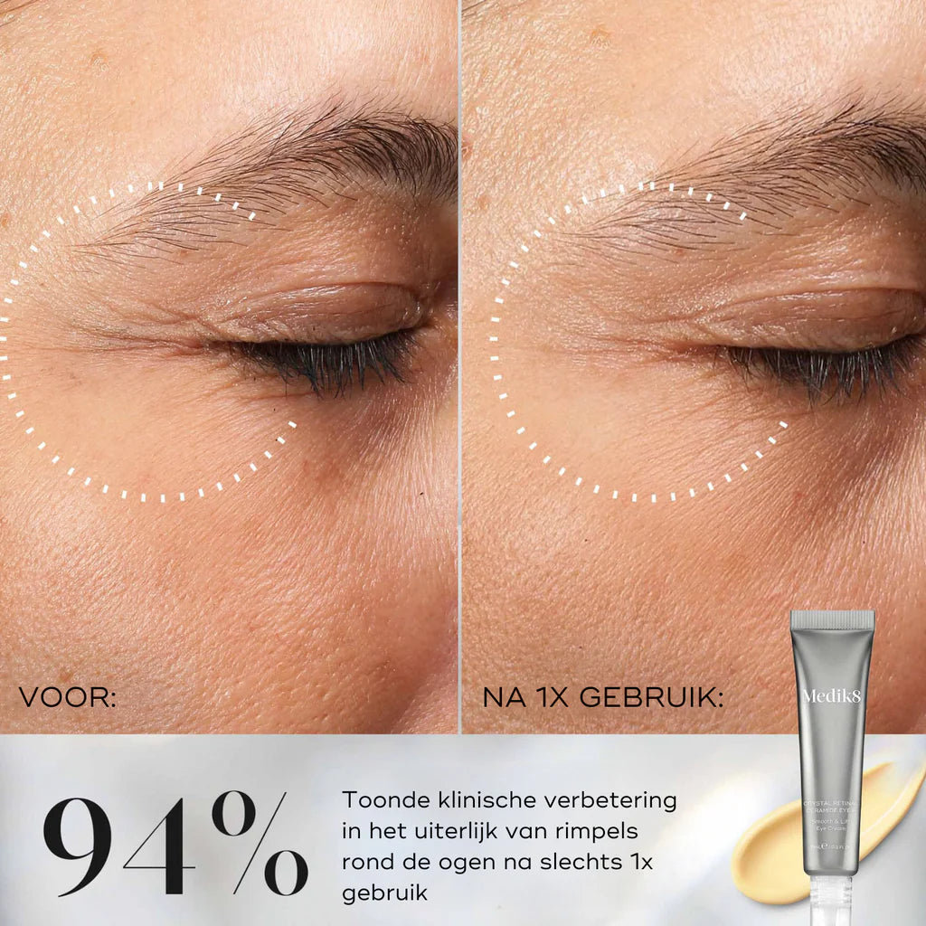 Crystal Retinal Ceramide Eye